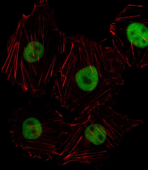 Polyclonal Rabbit anti-Human HOXD8 Antibody (aa243-270, IF, WB)