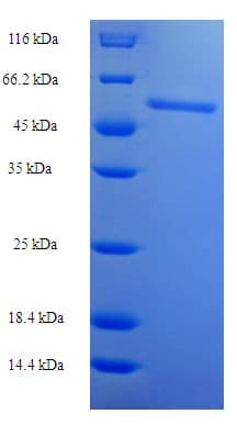 Human GMPR2 Protein (Recombinant His-SUMO)