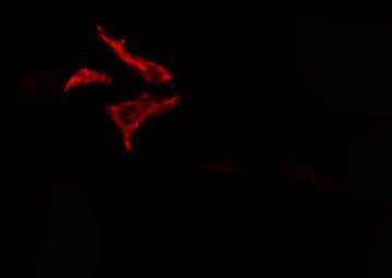 FZD7 / Frizzled 7 Antibody