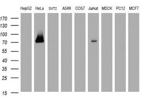 Monoclonal Mouse anti-Human GLB1 / Beta-Galactosidase Antibody (clone OTI1E10, IHC, WB)