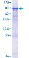 Human CLEC14A Protein (Recombinant GST)