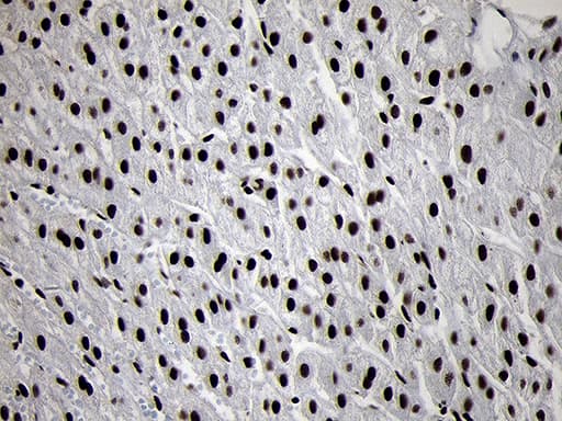 SMC1A / SMC1 Antibody (aa889-1016, clone OTI11E1)