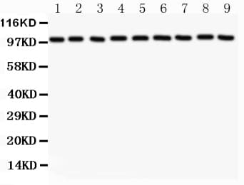 CTNNA1 / Catenin Alpha-1 Antibody (aa143-292)