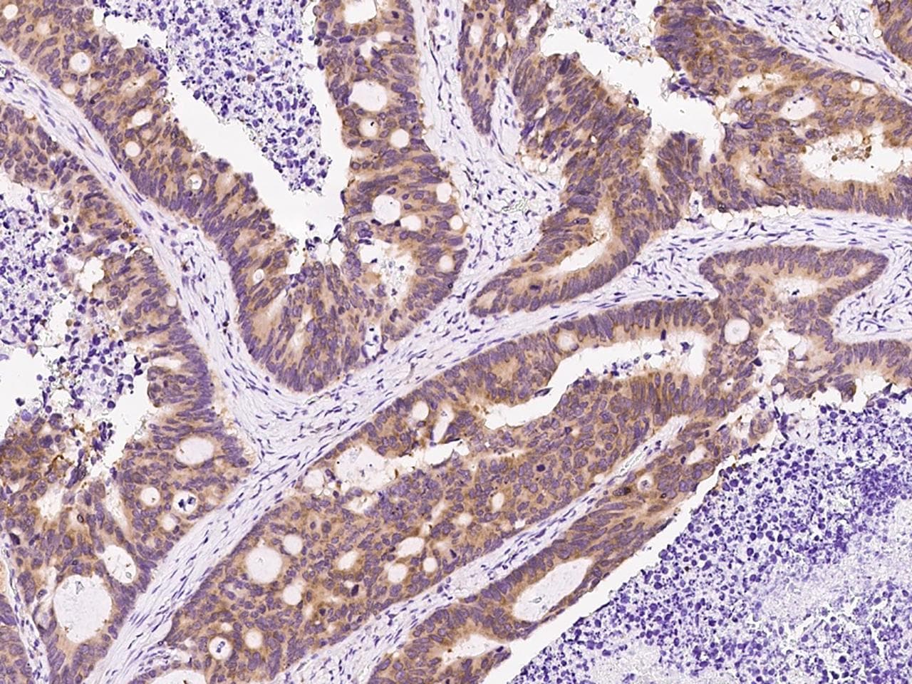PABPC1 / PABP1 Antibody (Preservative Free)