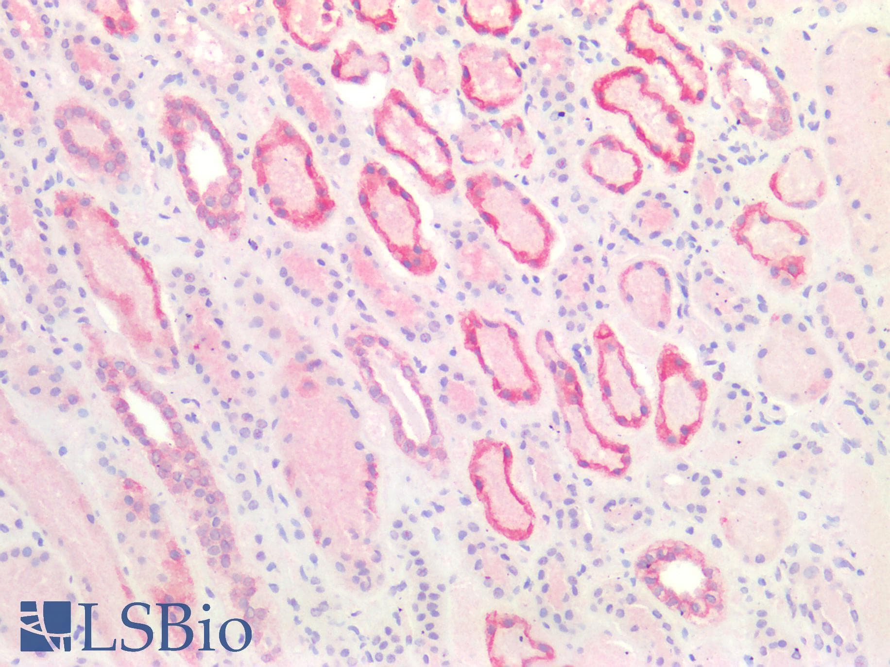 PathPlus™ c-Kit / CD117 Antibody (aa685-697)