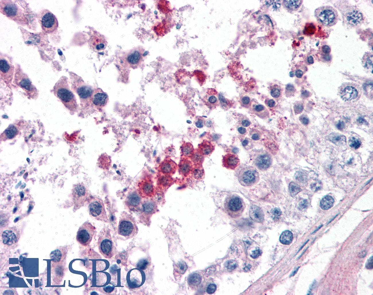 IHC-plus™ SEPT3 / Septin 3 Antibody (aa15-26)