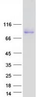 Human VCAM1 / CD106 Protein (Recombinant Myc-DDK (Flag))