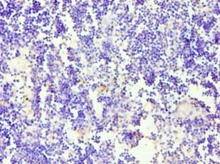 CD84 / SLAMF5 Antibody (aa22-225)