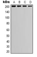 Tuberin / TSC2 Antibody (Internal)
