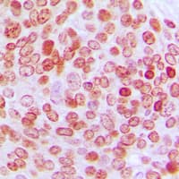 Polyclonal Rabbit anti-Human ERF / PE2 Antibody (C-Terminus, IHC, WB)