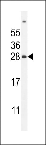 FAT10 / UBD Antibody (aa120-153)
