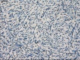 LTA4H / LTA4 Antibody (clone OTI3C11)