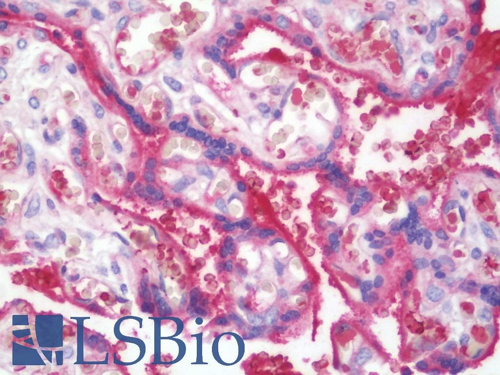 IHC-plus™ Polyclonal Rabbit anti-Human TREM1 Antibody (aa162-191, IHC, WB)