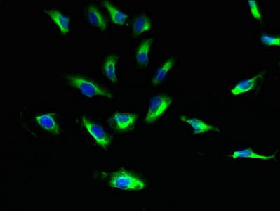 Polyclonal Rabbit anti-Human SUCNR1 / GPR91 Antibody