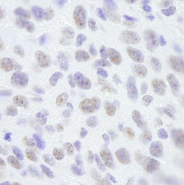 SAFB1 / SAFB Antibody (aa875-C-term)