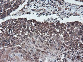 DPH2 Antibody (clone OTI4E7)
