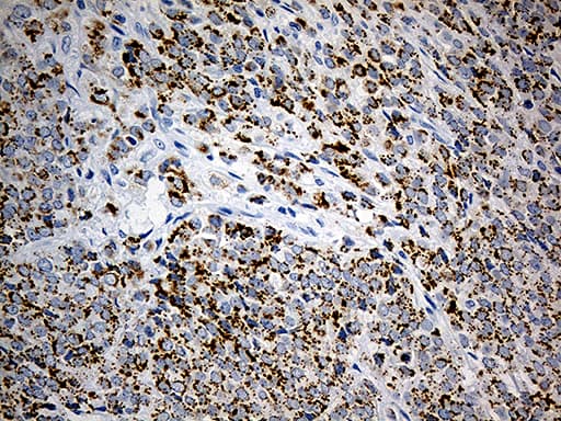 PLIN5 / OXPAT / LSDP5 Antibody (aa1-463, clone OTI3F2)