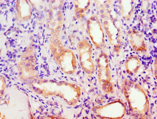 MCAD / ACADM Antibody (aa26-421)
