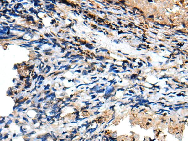 CSRP3 Antibody