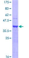 Human LOXL4 / LOXC Protein (Recombinant GST, N-terminus)