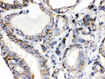 Polyclonal Rabbit anti-Human CALCA Antibody (IHC)