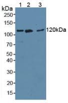 VCL / Vinculin Antibody