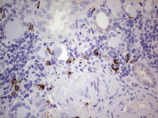 Monoclonal Mouse anti-Human GLI / GLI1 Antibody (clone UMAB170, Carrier-free, aa1-410, IHC, IF, WB)