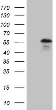 YBX1 / YB1 Antibody (clone OTI2C9, Carrier-free)