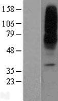 SLC29A1 / ENT1 Protein (Over-Expression Lysate Myc-DDK (Flag))