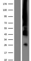 ER Alpha / Estrogen Receptor Protein (Over-Expression Lysate Myc-DDK (Flag))