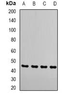 IHC-plus™ RRM2 Antibody