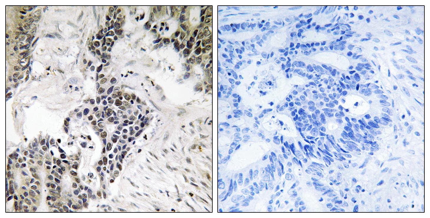 CDC25C Antibody (phospho-Ser198)