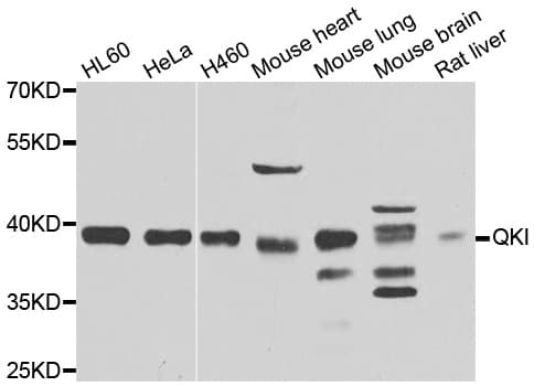 Polyclonal Rabbit anti-Human QKI Antibody (IHC, IF, WB)