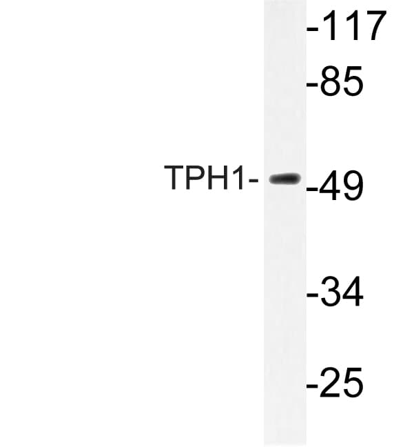 TPH1 / Tryptophan Hydroxylase Antibody (Lys54)