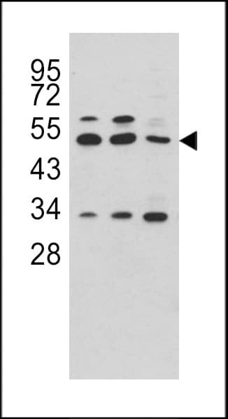 CPA4 Antibody (aa305-336)
