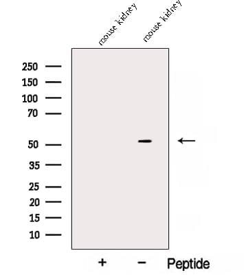 ALDH5A1 Antibody
