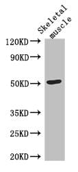 Polyclonal Rabbit anti-Human TUBG2 / Tubulin Gamma 2 Antibody (IHC)