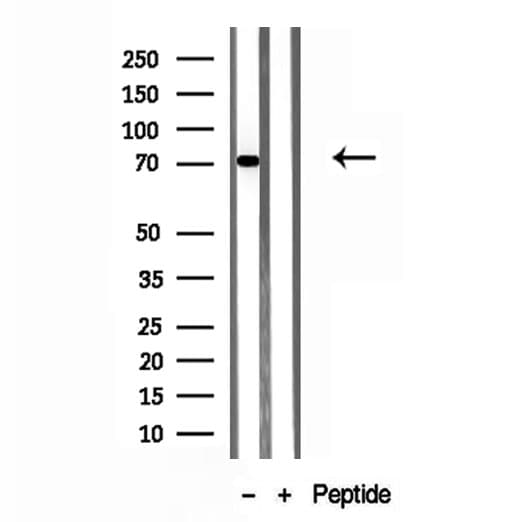 ACSL4 / FACL4 Antibody