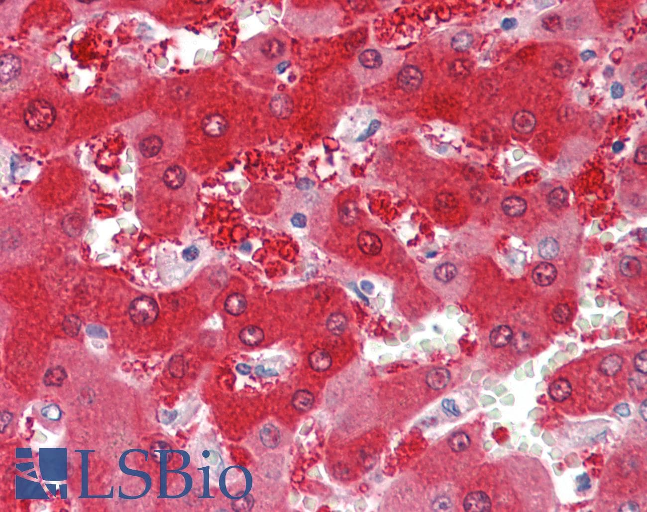 IHC-plus™ Monoclonal Mouse anti-Human CYP1A1 Antibody (clone 6G5, IHC, WB)