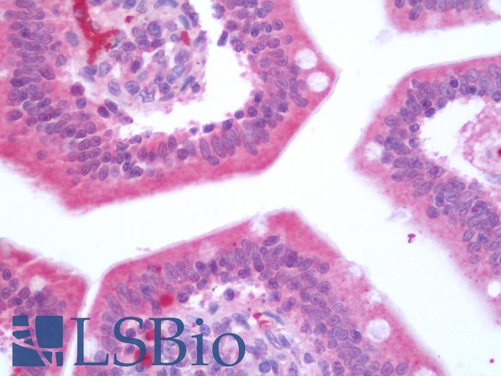 PathPlus™ Polyclonal Rabbit anti-Human CX3CL1 / Fractalkine Antibody (IHC, WB)