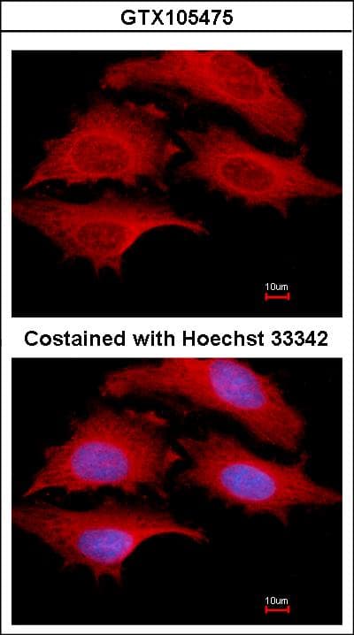 GSPT1 Antibody