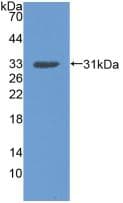 DDR2 Antibody (aa578-817)