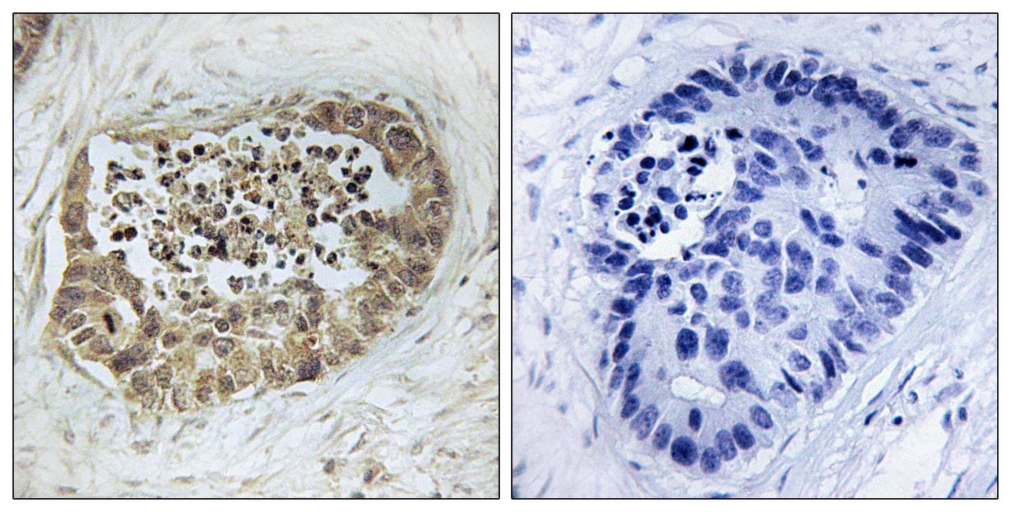 SMC1A / SMC1 Antibody (phospho-Ser966)