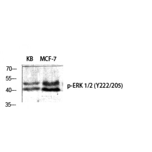 ERK1 + ERK2 Antibody (140-220 aa)