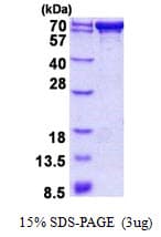 Human PDZK1 Protein (Recombinant His)