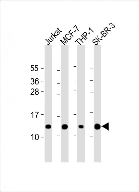 RPS27 / Ribosomal Protein S27 Antibody (N-Terminus)