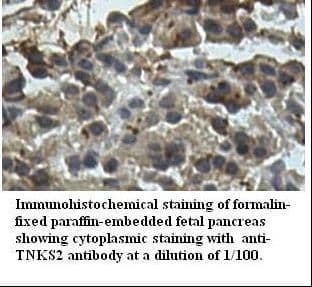 TANK2 / TNKS2 Antibody