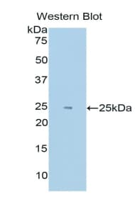 HIF2A / EPAS1 Antibody (aa339-541, APC)