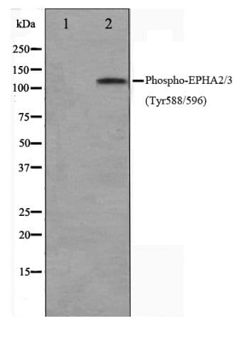 EPH Receptor A2+A3 Antibody (phospho-Tyr588/596)