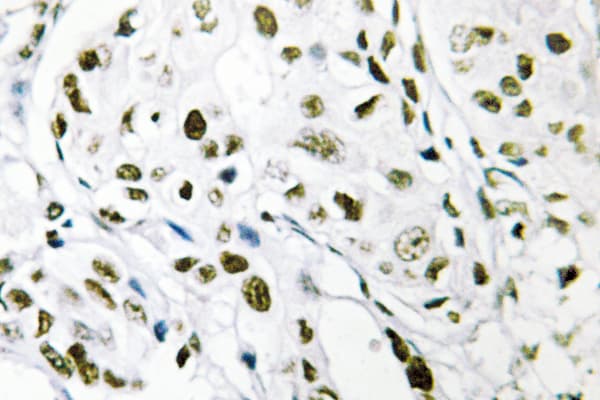 Polyclonal Rabbit anti-Human TCEB3 / Elongin A Antibody (Arg129, IHC, WB)